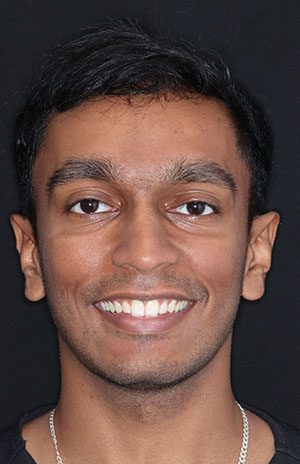 Dr Sathisha Gunewardena (Teesh)