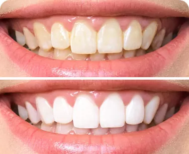 Booth Tooth Dental photo 4