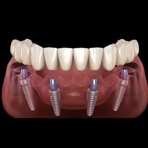 Teeth Plus Clinic Annandale photo 3