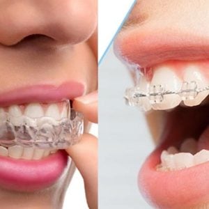 Teeth Plus Clinic Annandale photo 4