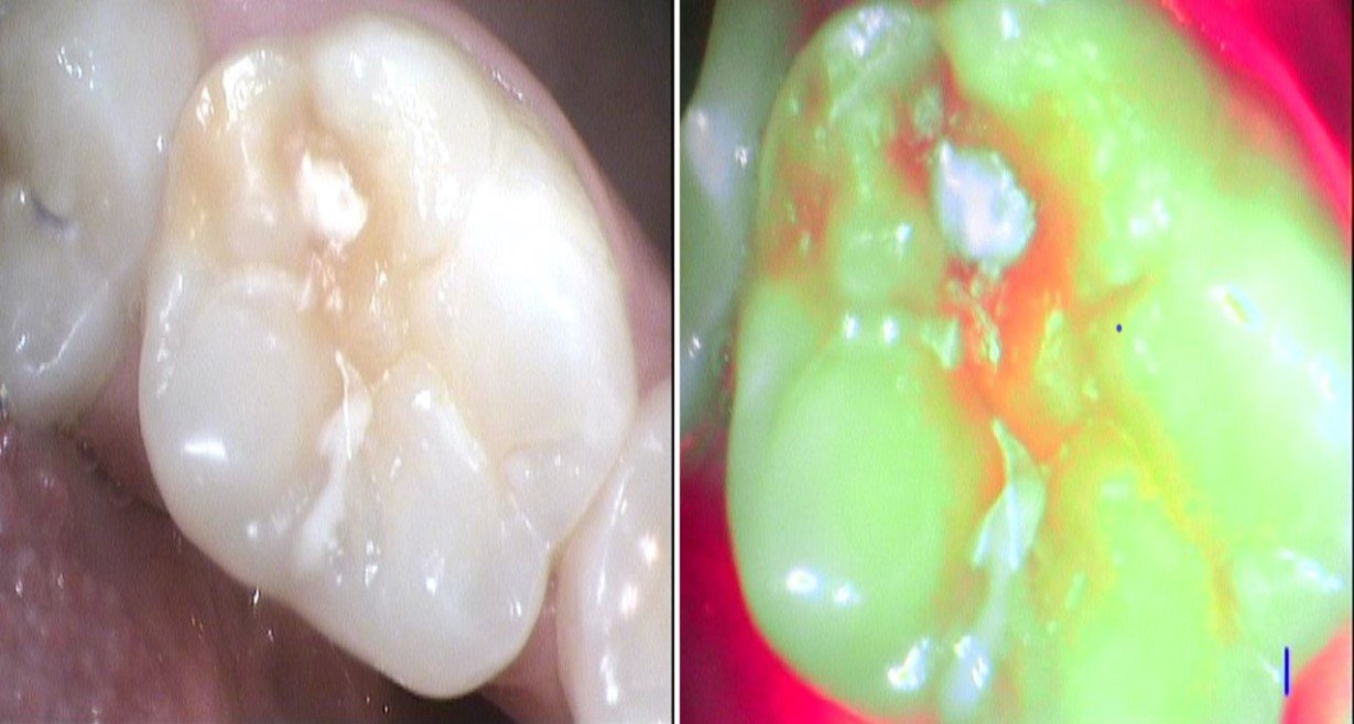 Dental on Marsh photo 4