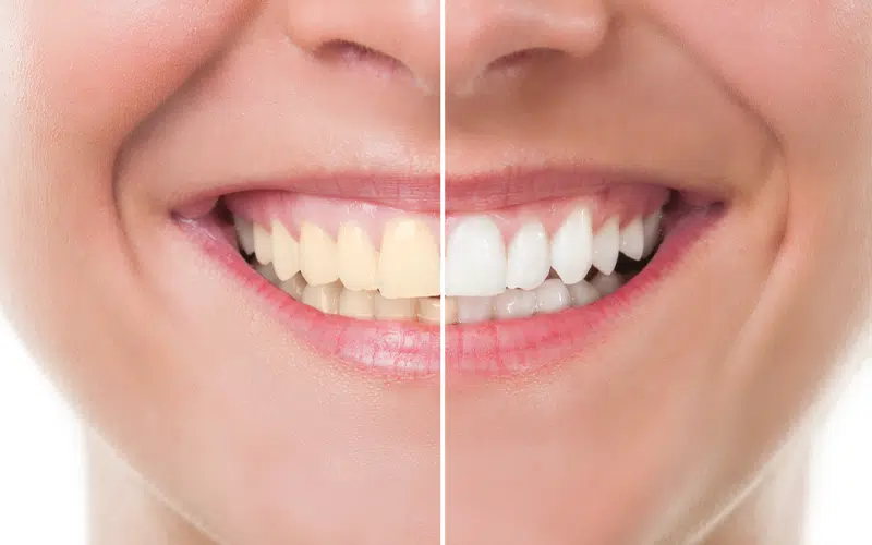 Ashgrove West Dental photo 4
