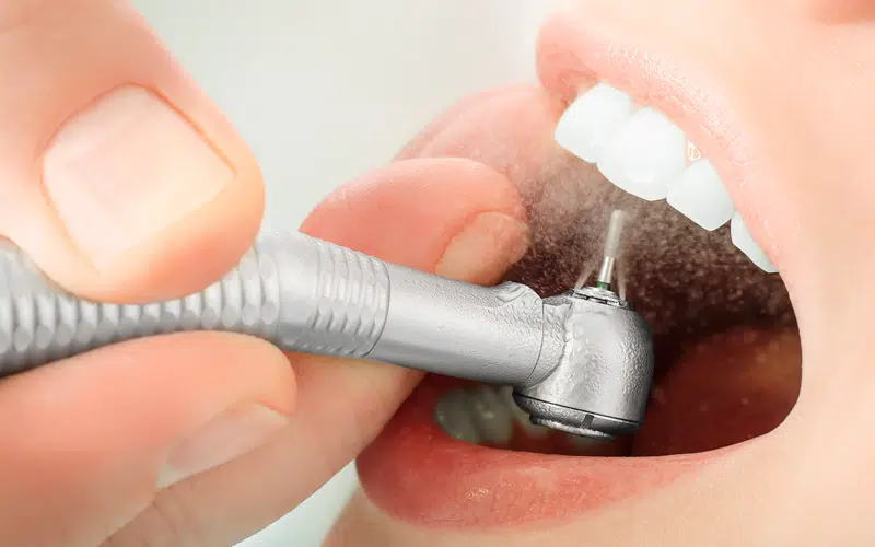 Ashgrove West Dental photo 3