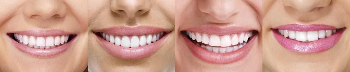 Ash Dental photo 3