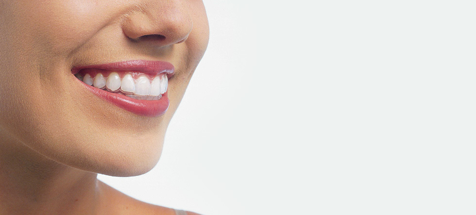 Orthosmile Orthodontics photo 2