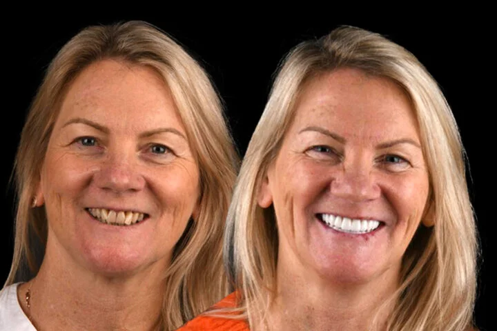 Avoca Beach Dental | Dentist in Central Coast | Dental Implants and Cosmetic Dentistry photo 1