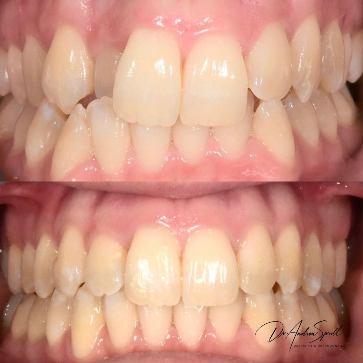 Avoca Beach Dental | Dentist in Central Coast | Dental Implants and Cosmetic Dentistry photo 3