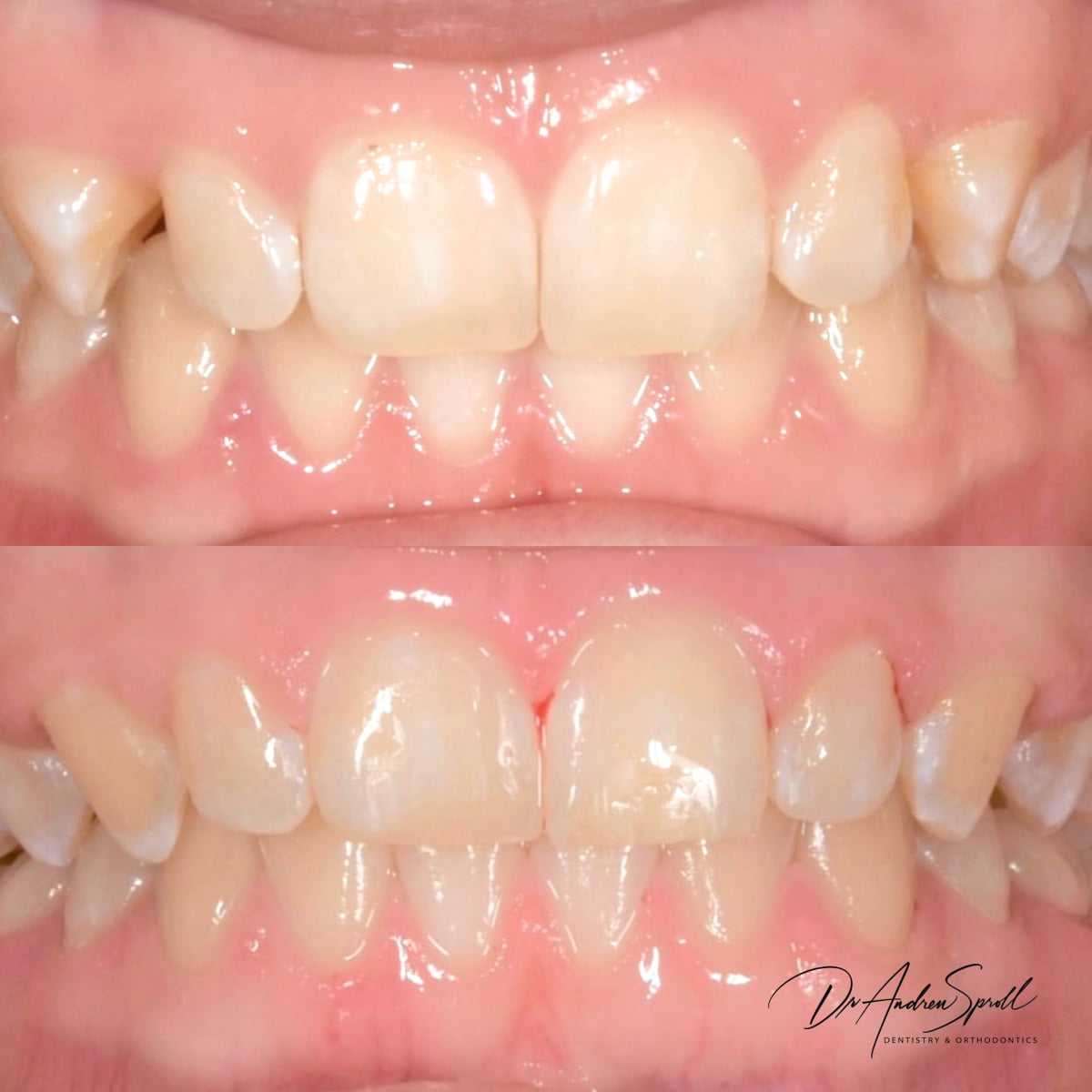 Avoca Beach Dental | Dentist in Central Coast | Dental Implants and Cosmetic Dentistry photo 4