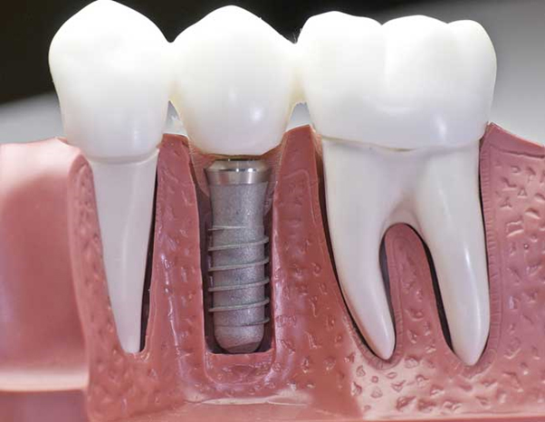 Dental Care St Kilda photo 3
