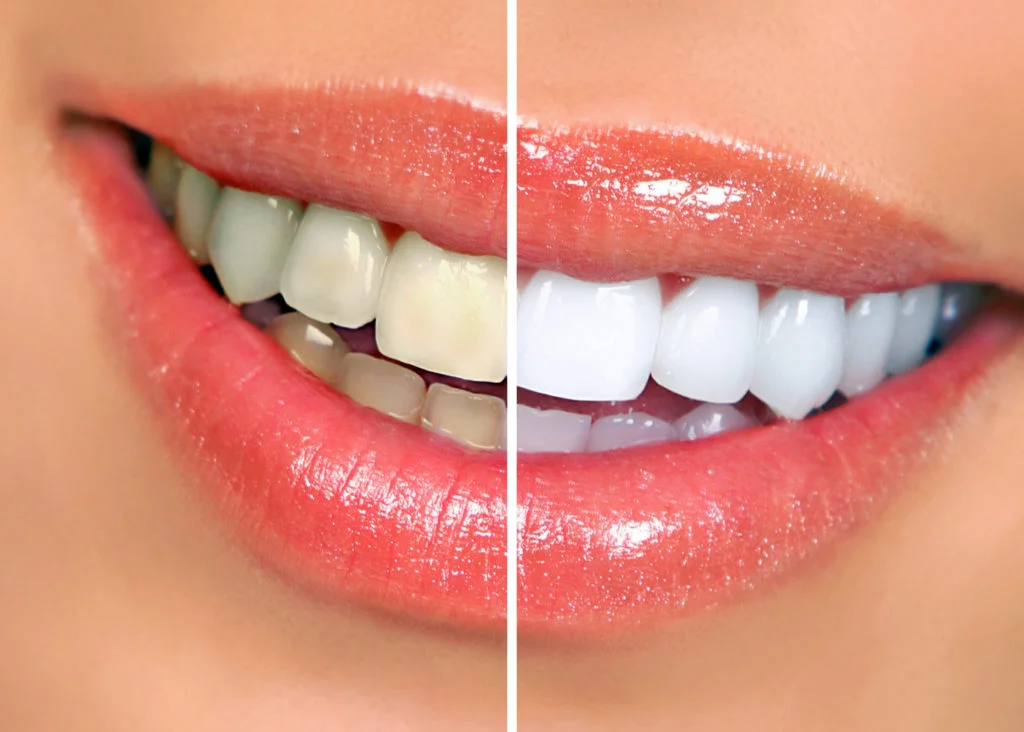 Baldivis Family Dental Care photo 1