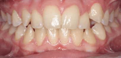 Beachside Orthodontics photo 2