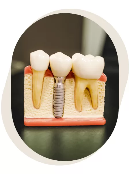 Balmain Dentist photo 4