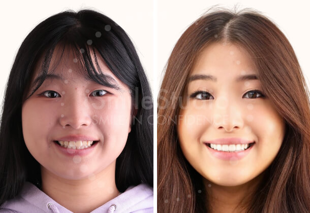 iSmile Studio photo 4