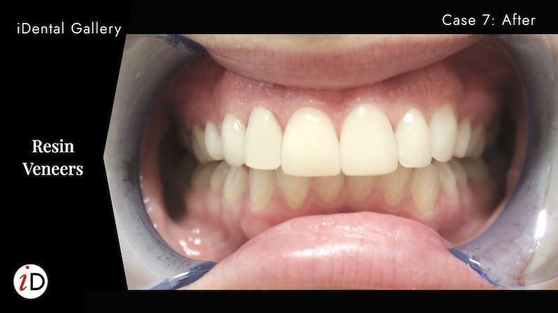iDental photo 4