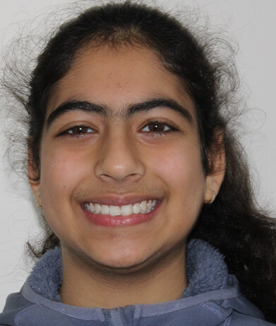 Angle House Orthodontics photo 3