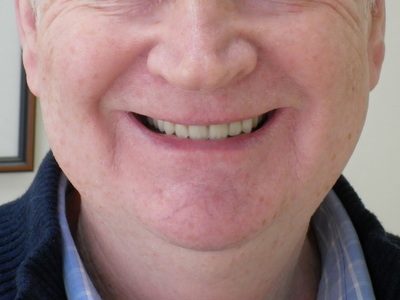 Balwyn Denture Clinic photo 3