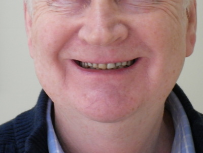 Balwyn Denture Clinic photo 2