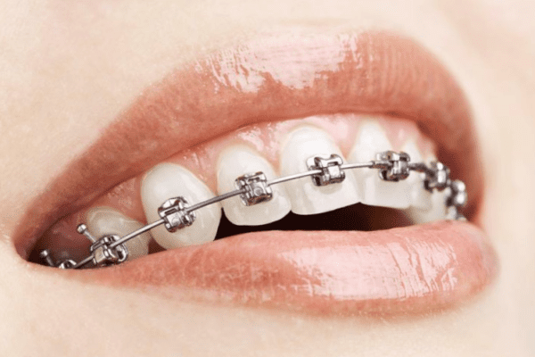 Smile Council Orthodontics photo 4