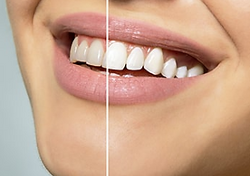 Koudmani Dental Bangor photo 3