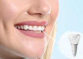 Koudmani Dental Bangor photo 4