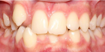 Smile Line Dental Care - Dentist Bankstown photo 4