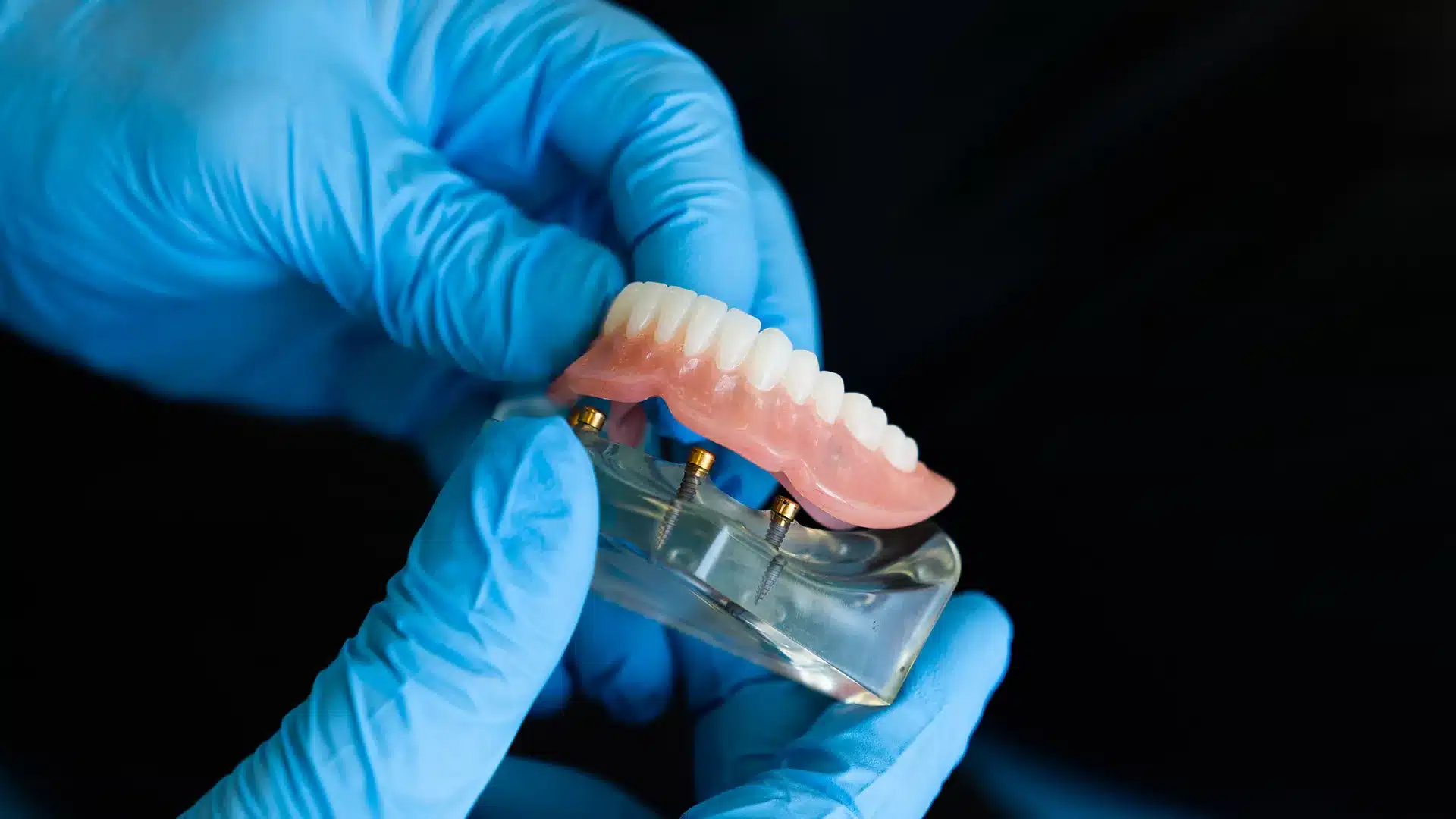 Emergency Denture Repairs - Bassendean photo 1