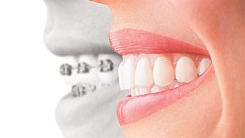 Inline Smiles Clinic photo 4