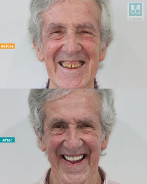bc dental photo 4