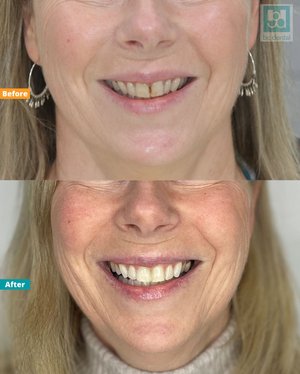 bc dental photo 3