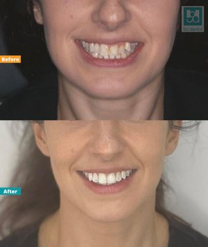 bc dental photo 2