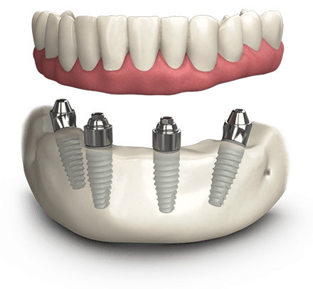 Bayside Family Dentistry photo 3