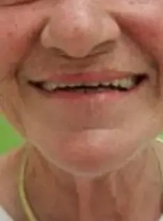 Beerwah Denture Clinic - Dental Implant Dentist photo 2