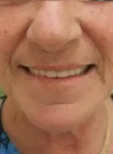 Beerwah Denture Clinic - Dental Implant Dentist photo 3
