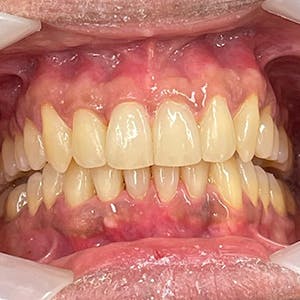 Norwest Dental Care photo 4