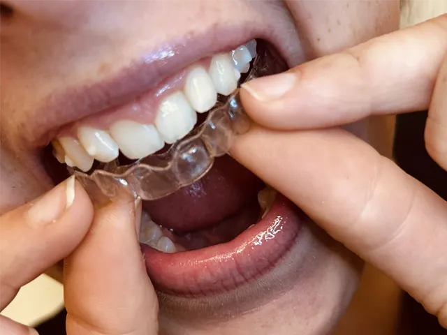 Humphrey Dental photo 3