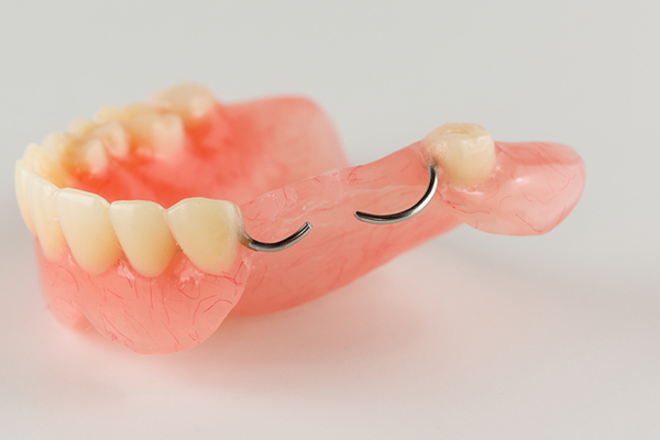 Chris Hewitson Dentures Plus photo 3