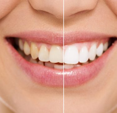 Precision Dental Group photo 2