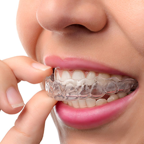 Wilkinson Orthodontics photo 3