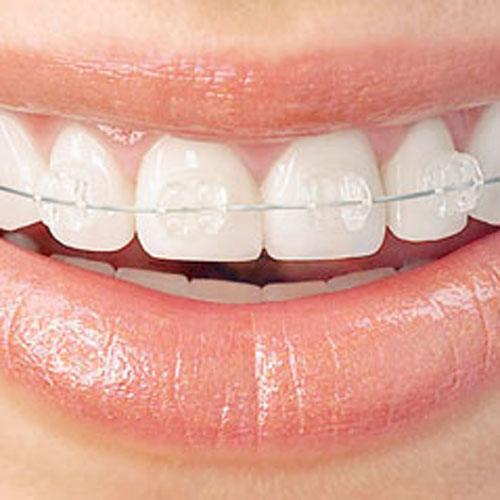 Wilkinson Orthodontics photo 2