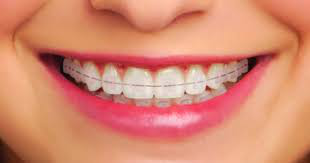Smiles @ Bronberg (DENTIST) photo 3