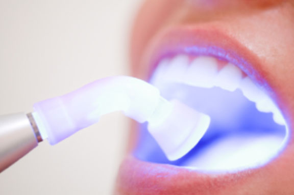 Bent Street Dental Clinic photo 3