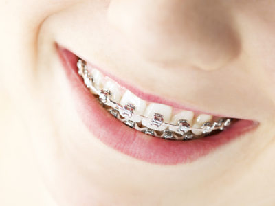 Berowra Dental Care photo 3