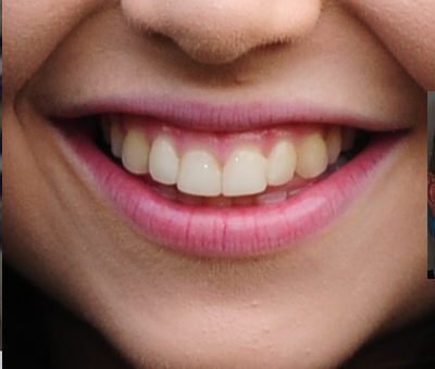 A Better Dental Care photo 1