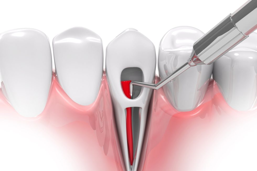 Aelite Dental photo 3