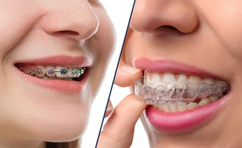 Blackburn Smiles Dental photo 3