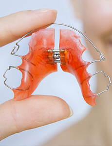 Blackburn Orthodontics photo 4