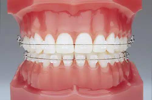 Smiles & Faces Orthodontics photo 1