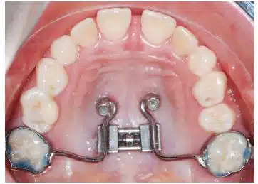 Smiles & Faces Orthodontics photo 2