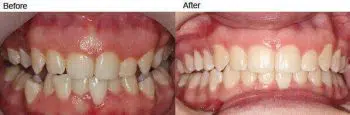 Smiles & Faces Orthodontics photo 3