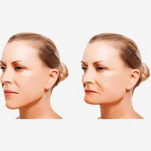 Sydney Implant Studio photo 4